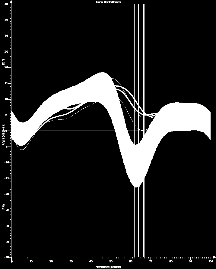 Plantarflexion Dorsiflexion Ortosutvärdering (vä ben=röda linjer,