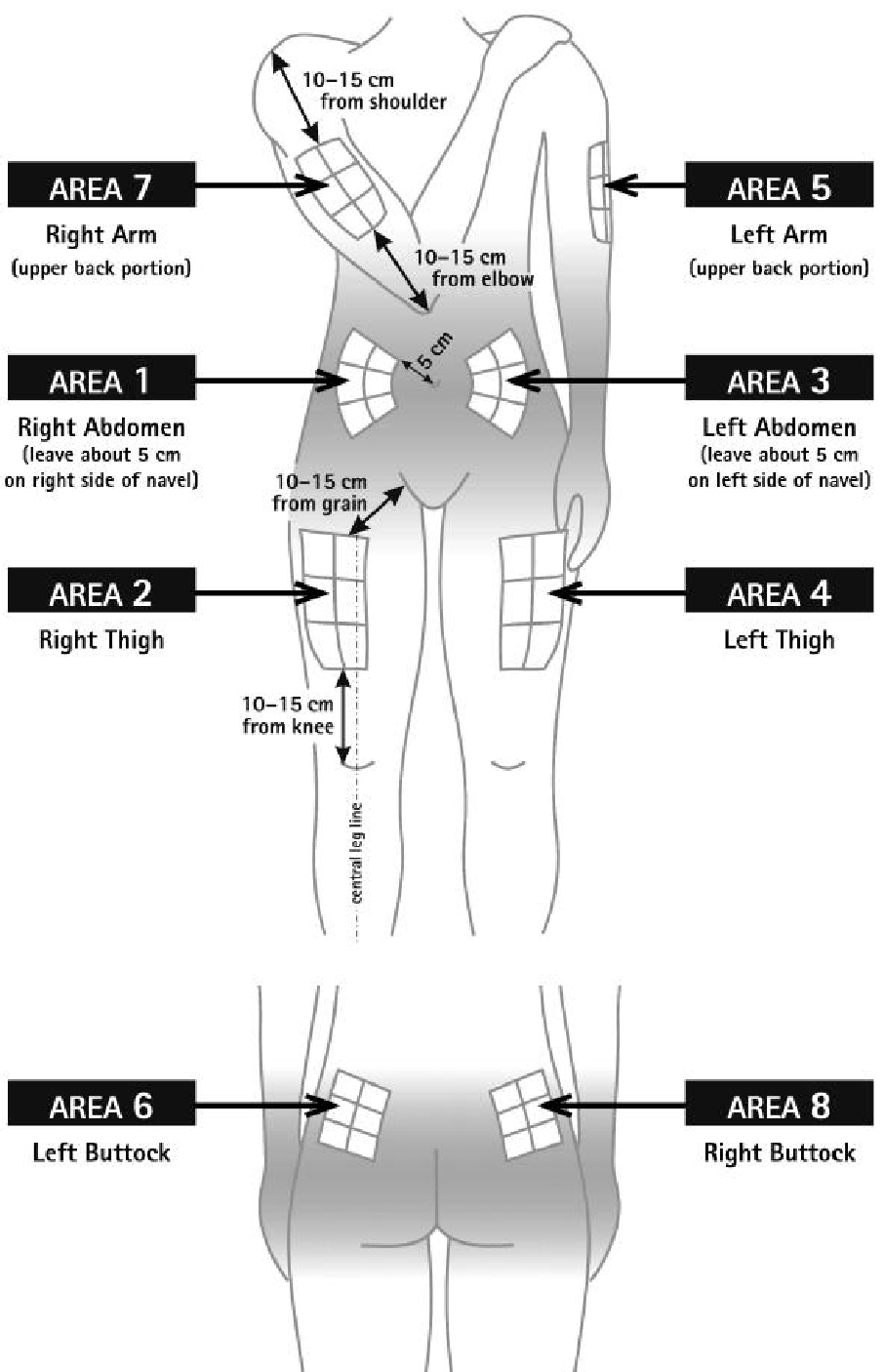 Benets mittlinje ROTATIONSSCHEMA: 10-15 cm från axeln OMRÅDE 1 Höger arm (överarmens baksida) 10-15 cm från armbågen OMRÅDE 2 Vänster arm (överarmens baksida) OMRÅDE 3 OMRÅDE 4 Höger sida av buken (5