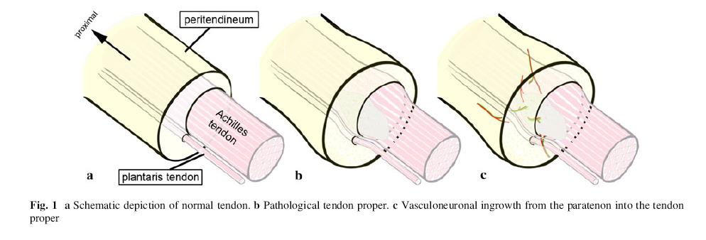 Abates M et al, 2009, Arthritis Research & Therapy