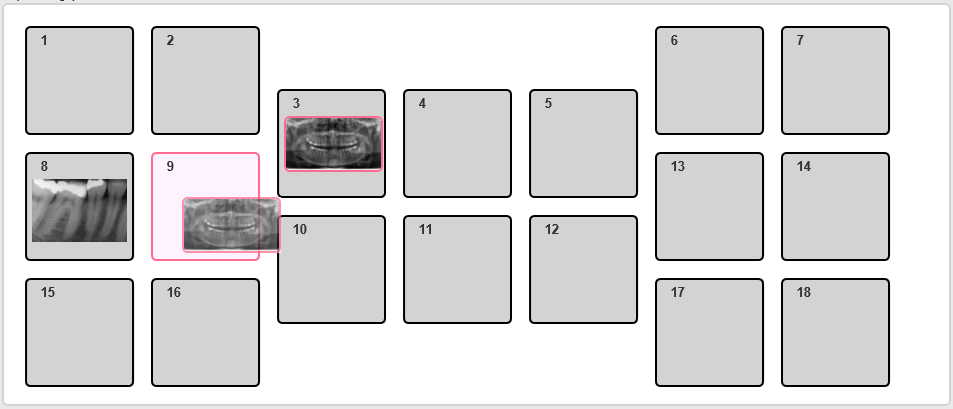 ) Tillagda bildkartor visas som en horisontell lista med miniatyrbilder där året/åren då de bifogade bilderna är tagna visas under kartmodellen.