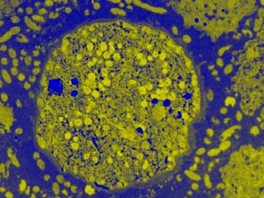 12 Den vattenburna makrofagen A. castellanii tar upp bakterier som förökar sig i cytoplasma av A. castellanii trofozoit som kan återgå till cysta. V. mimicus har förökat sig A.