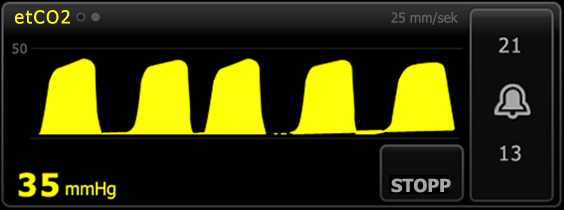 Bruksanvisning Patientövervakning 95 etco2-numerisk vy Den numeriska vyn visar sluttidal koldioxid (etco2) och andel koldioxid i inandningsluften (FiCO2) i mmhg eller kpa.