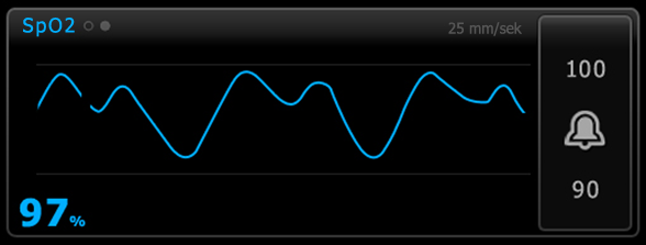 Bruksanvisning Patientövervakning 133 SpO2-vågformsvy Vågformsvyn visar SpO2 -pletysmografikurvan i realtid.