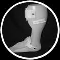 14 Fotortoser (FO) 06.12.03 Ortos som omfattar hela eller delar av foten. Inkluderat är till exempel sulor, skoinlägg, pelotter, hålfotsstöd och hälinlägg. 15 Skor för diabetes/ neuropatisk fot 06.33.