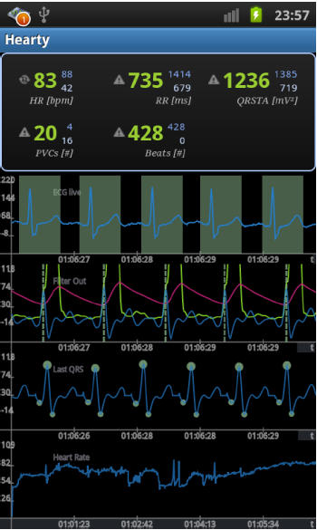 4 TEORI OCH BAKGRUND Ovanstående studier visar att det finns olika mobilapplikationer för tolkning av EKG-signaler, men resultatet presenteras med kurvor och medicinska termer vilket är svårt att