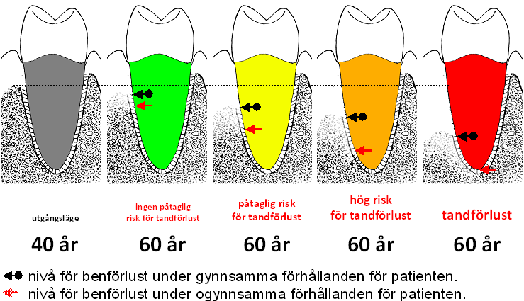 Mycket god prognos Tanden har inga tydliga riskprediktorer som försämrar prognosen.