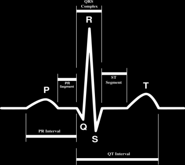 EKG