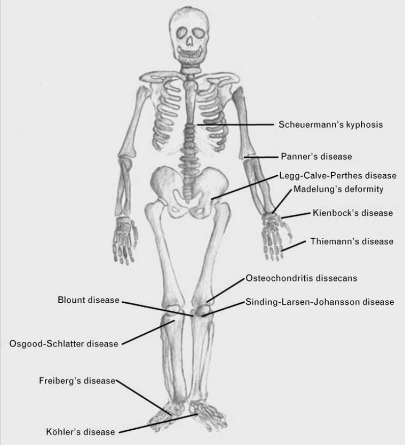 Other sources Chronic Low Back Pain