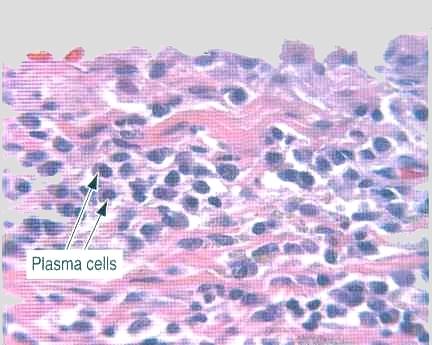 Histologisk färgning (HE) 1) Hematoxylin är ett blått färgämne.