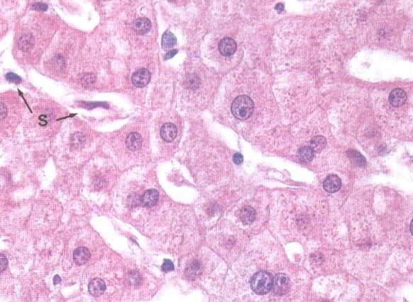 Ljusmikroskopisk histologisk analys: fortfarande patologens viktigaste verktyg