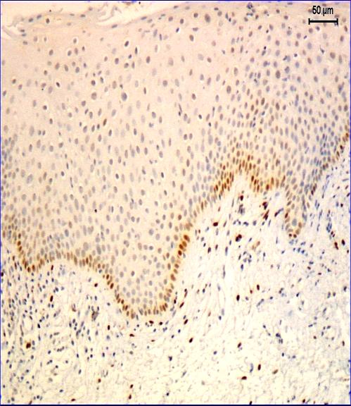 and shallower COC- more superficial vessels LPV more ERα