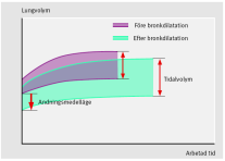 Ett fåtal patienter får rehabilitering Barriärer för implementering av lungrehabilitering Remiss från läkare Tillgång till rehab Patientbarriärer Logistik (för stor arbetsbörda) Tillgång till rehab