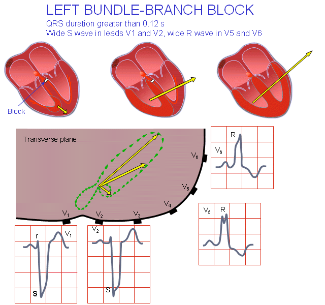 EKG introduktion