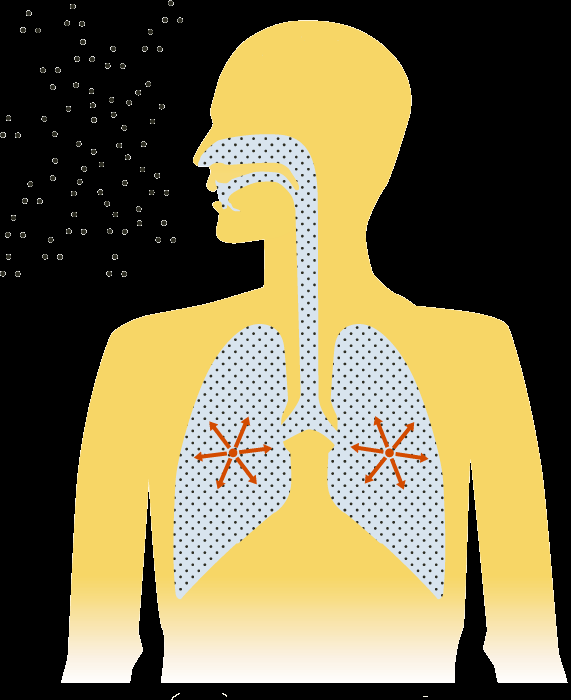 Risken för lungcancer från radon i inomhusluft Radon kommer ut i inomhusluften Radonet sönderfaller till radondöttrar Radon och radondöttrar följer med luften in i luftrör