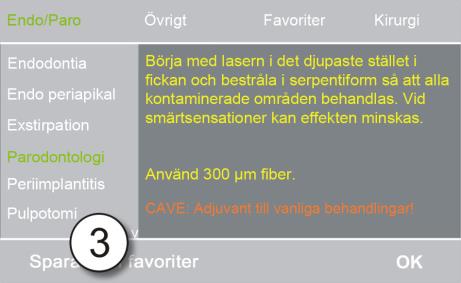 Betjäning 3.5. Bränna in Saphir-spetsen/BareFiber-spetsen 1.