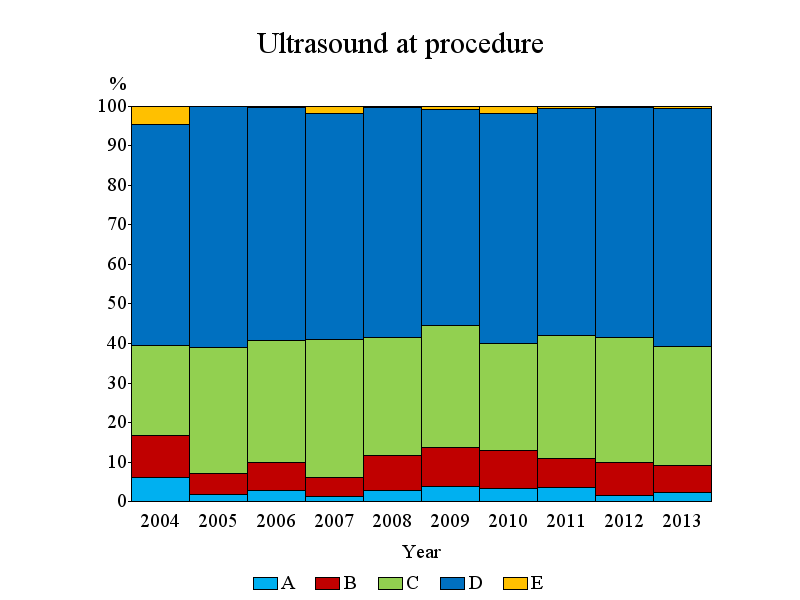 44 Figur 21. Ultraljudsundersökning preoperativt 2004-2013 A=Correct position of one pathologic gland, but multiglandular disease not predicted.