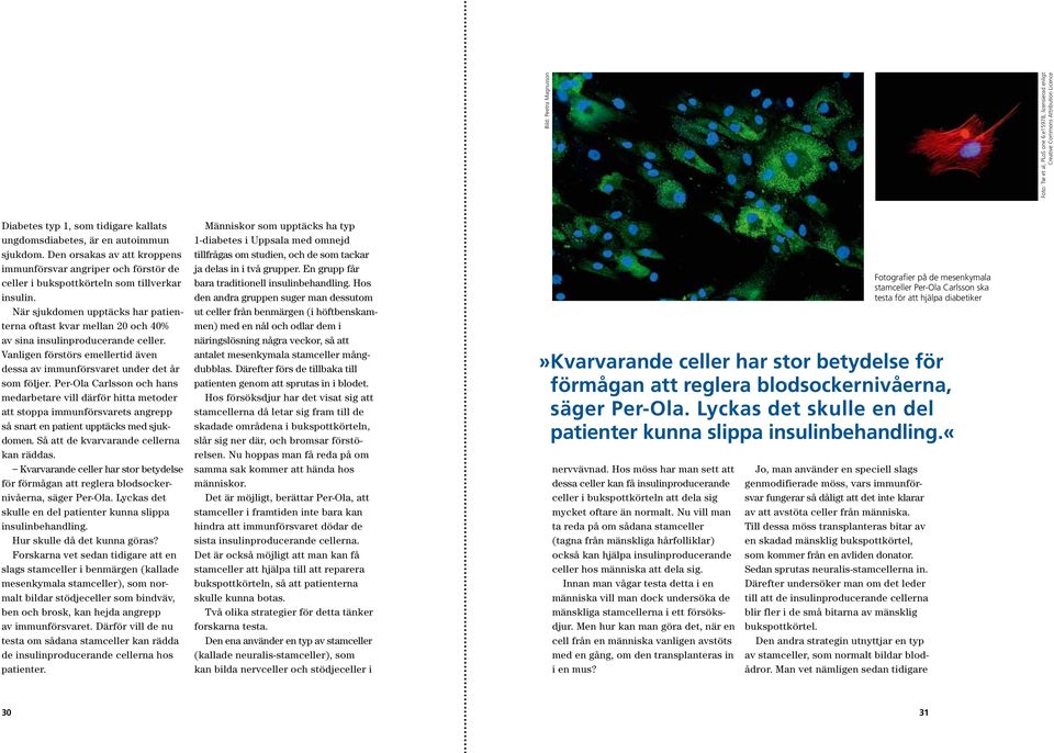 När sjukdomen upptäcks har patienterna oftast kvar mellan 20 och 40% av sina insulinproducerande celler. Vanligen förstörs emellertid även dessa av immunförsvaret under det år som följer.