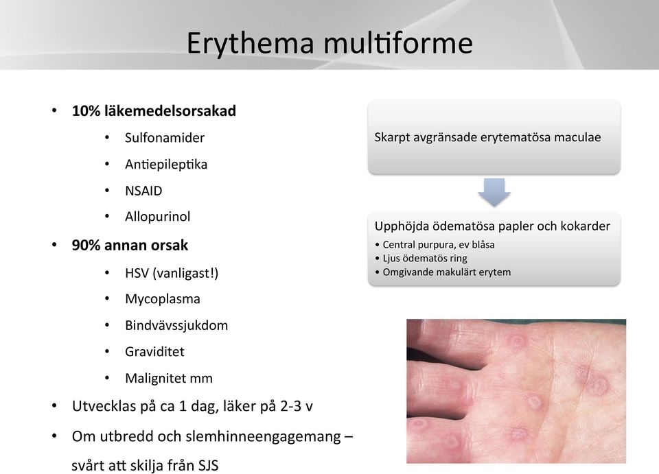 ) Mycoplasma Upphöjda ödematösa papler och kokarder Central purpura, ev blåsa Ljus ödematös ring