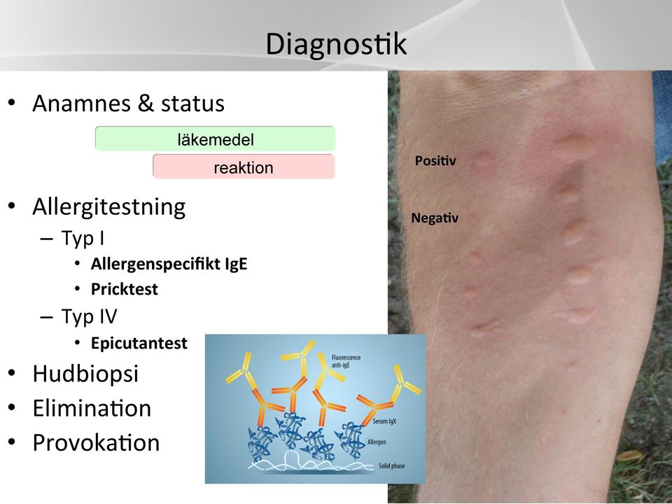 Allergenspecifikt IgE Pricktest Typ IV