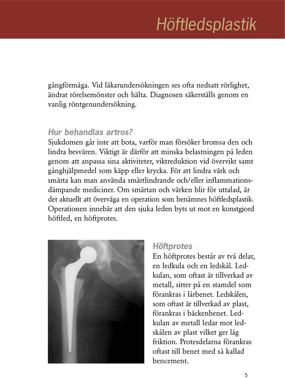 Viktigt är därför att minska belastningen på leden genom att anpassa sina aktiviteter, viktreduktion vid övervikt samt gånghjälpmedel som käpp eller krycka.