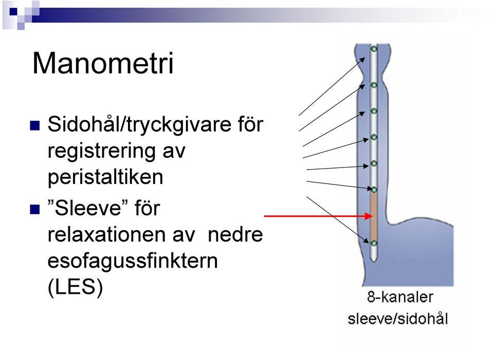 peristaltiken Sleeve för