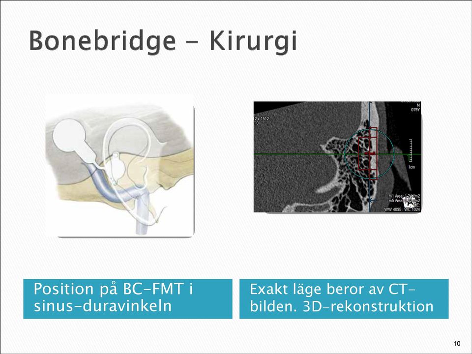 Exakt läge beror av