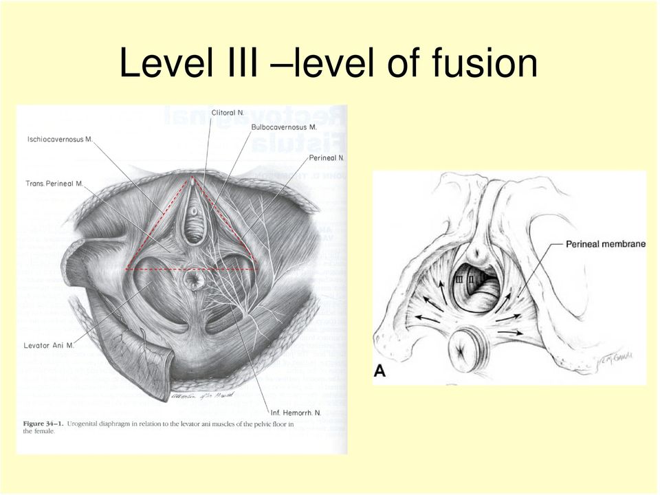 fusion