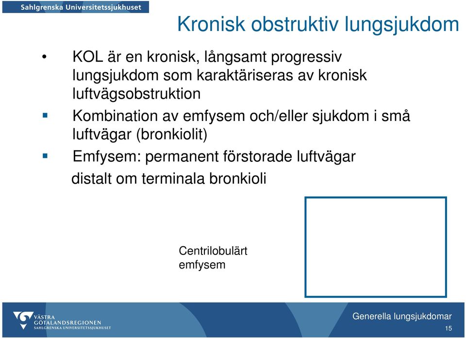 av emfysem och/eller sjukdom i små luftvägar (bronkiolit) Emfysem: