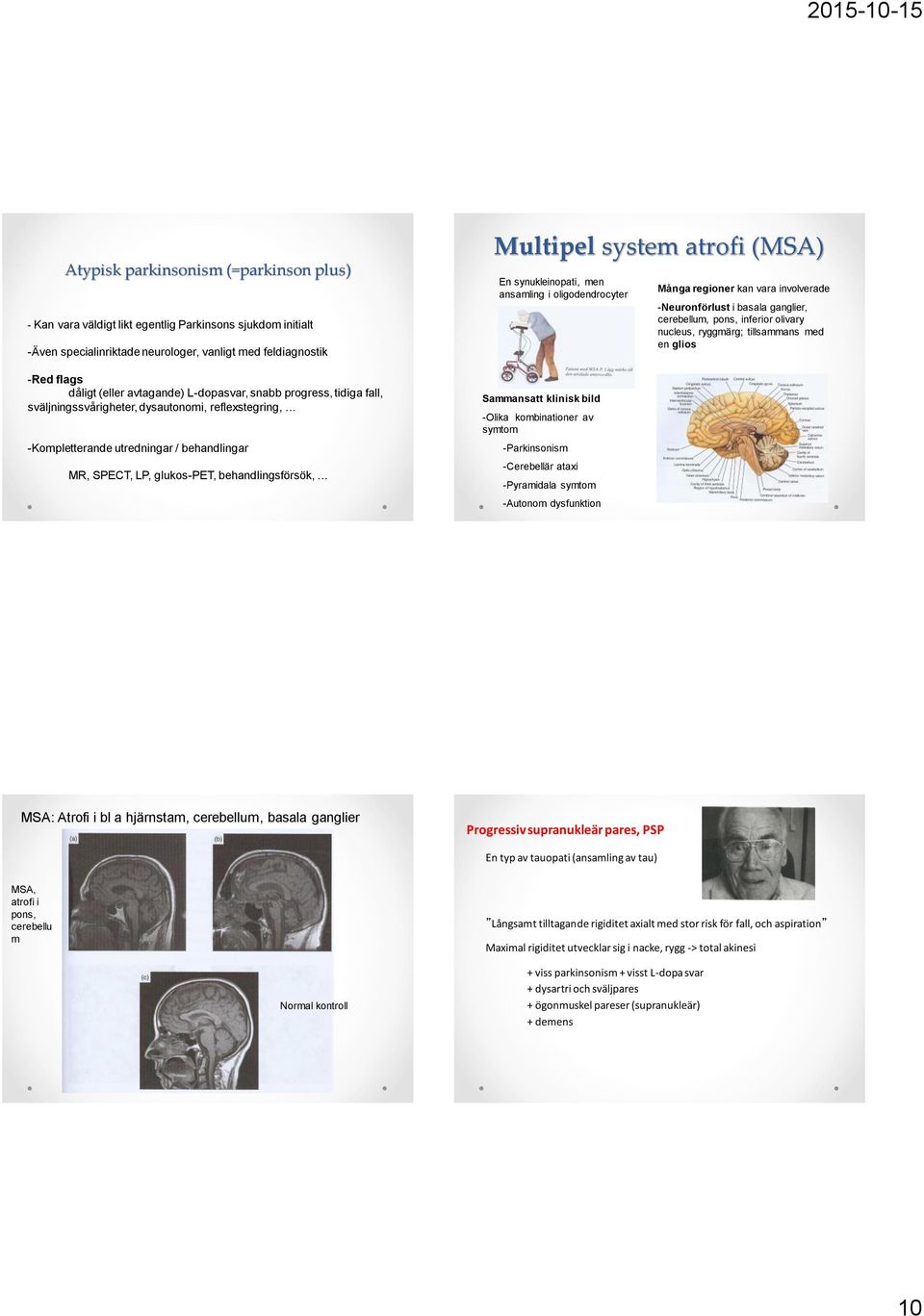 atrofi (MSA) En synukleinopati, men ansamling i oligodendrocyter Sammansatt klinisk bild -Olika kombinationer av symtom -Parkinsonism -Cerebellär ataxi -Pyramidala symtom -Autonom dysfunktion Många