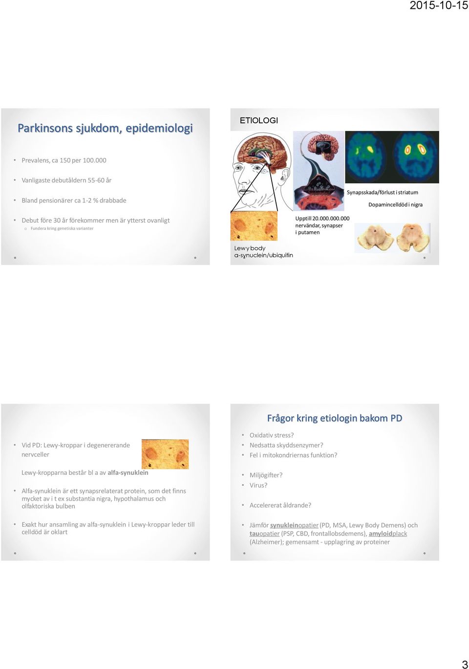 synapser i putamen Synapsskada/förlust i striatum Dopamincelldöd i nigra Lewy body a-synuclein/ubiquitin Frågor kring etiologin bakom PD Vid PD: Lewy-kroppar i degenererande nervceller Lewy-kropparna