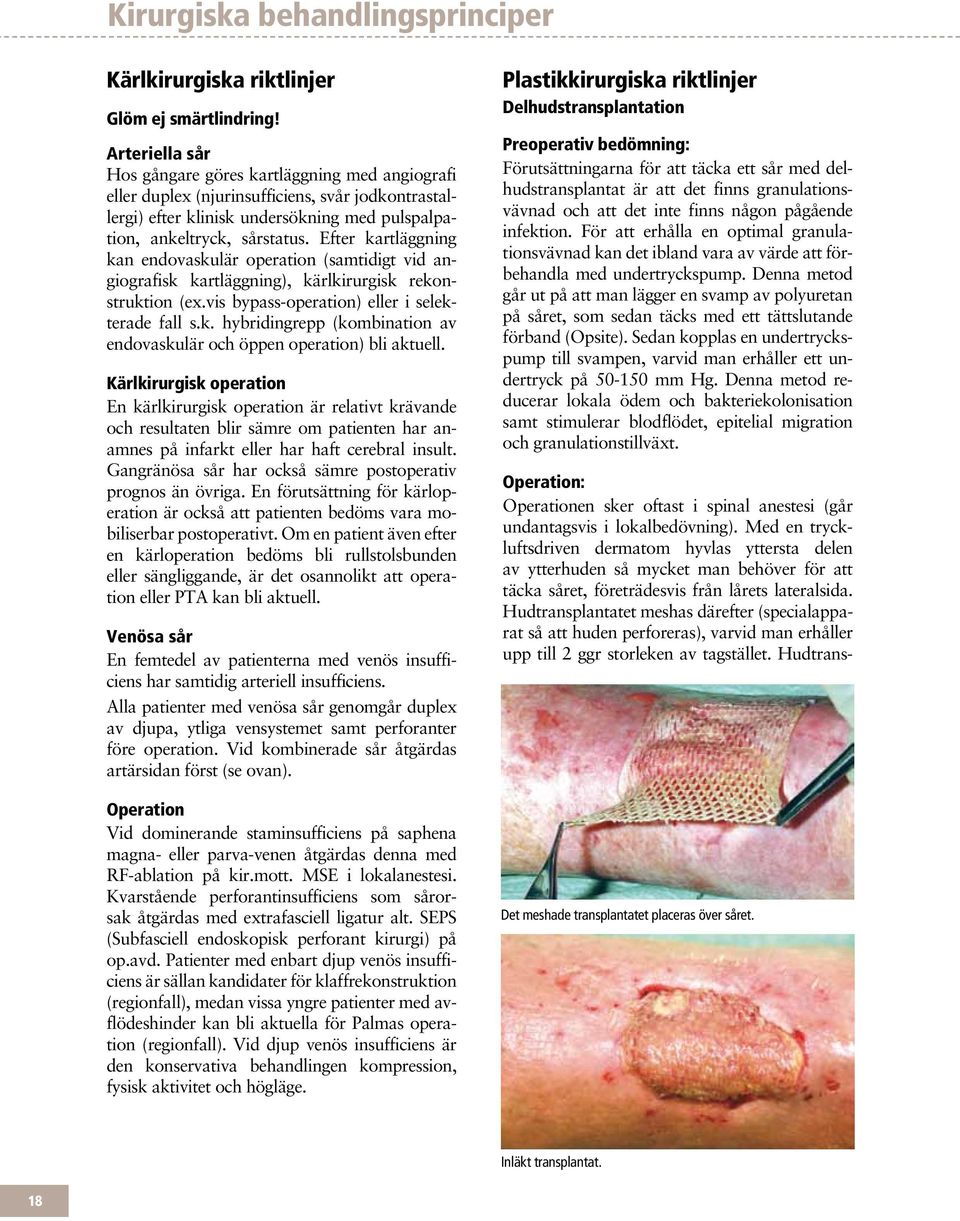 Efter kartläggning kan endovaskulär operation (samtidigt vid angiografisk kartläggning), kärlkirurgisk rekonstruktion (ex.vis bypass-operation) eller i selekterade fall s.k. hybridingrepp (kombination av endovaskulär och öppen operation) bli aktuell.