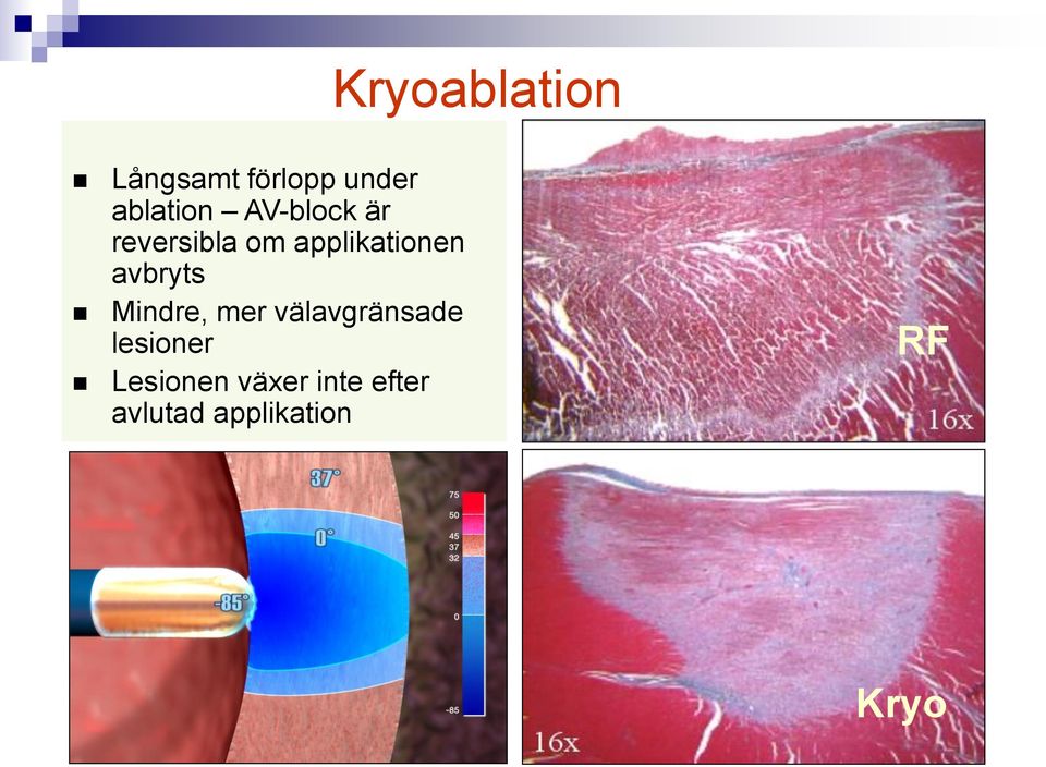 avbryts Mindre, mer välavgränsade lesioner