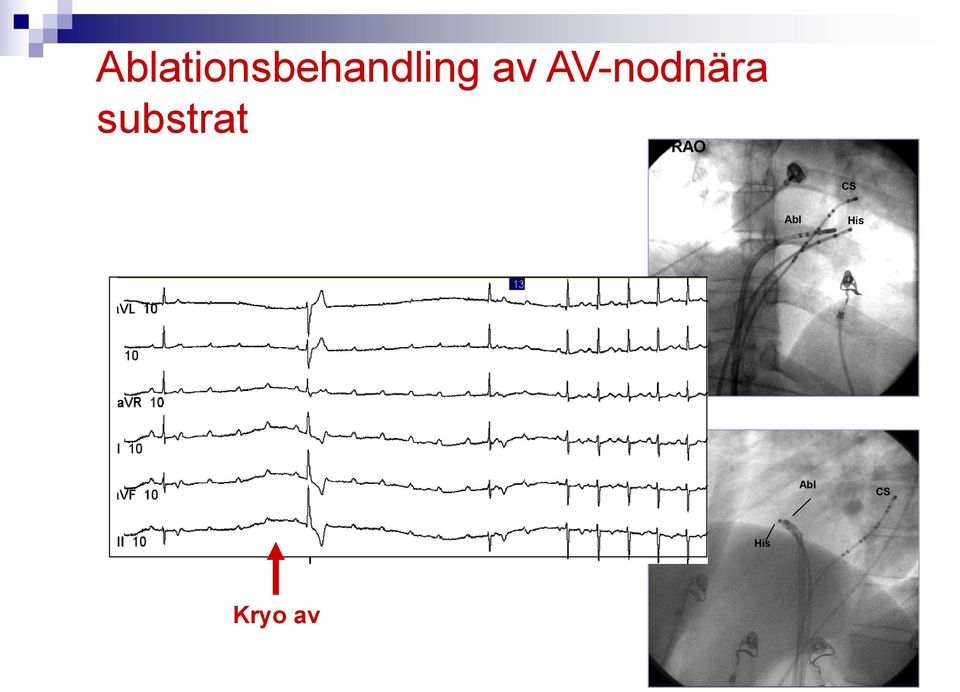 substrat RAO CS Abl