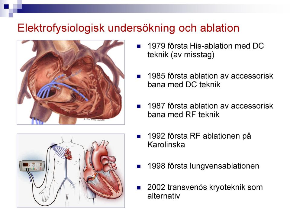 första ablation av accessorisk bana med RF teknik 1992 första RF ablationen på