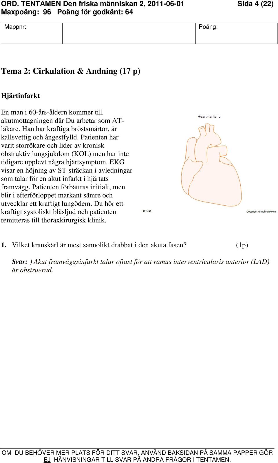 EKG visar en höjning av ST-sträckan i avledningar som talar för en akut infarkt i hjärtats framvägg.