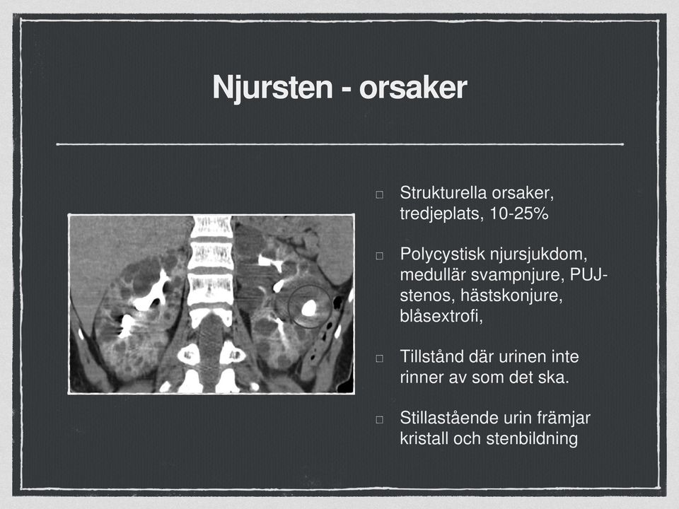 hästskonjure, blåsextrofi, Tillstånd där urinen inte rinner