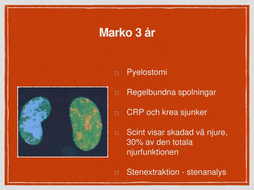 visar skadad vä njure, 30% av den