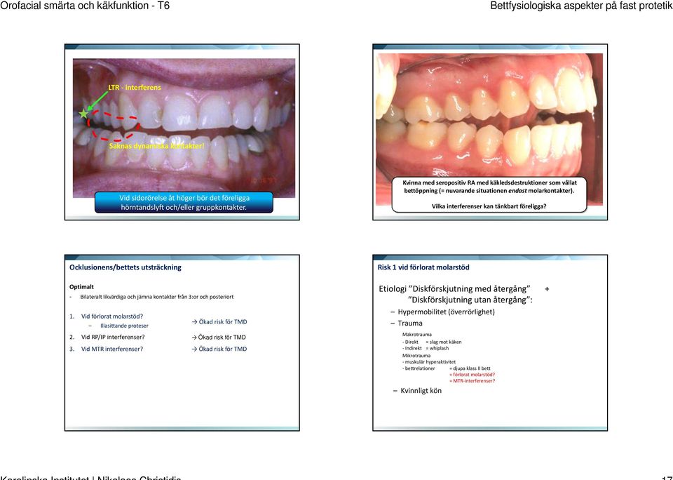 Ocklusionens/bettets utsträckning Optimalt Bilateralt likvärdiga och jämna kontakter från 3:or och posteriort 1. Vid förlorat molarstöd? Illasittande proteser Ökad risk för TMD 2.