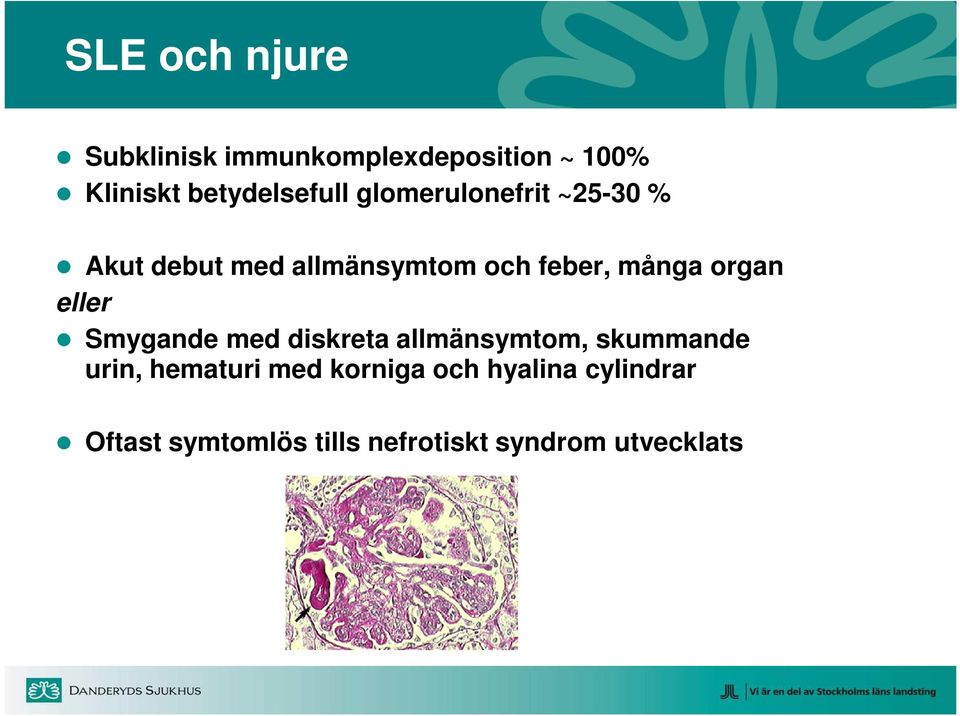 feber, många organ eller Smygande med diskreta allmänsymtom, skummande urin,