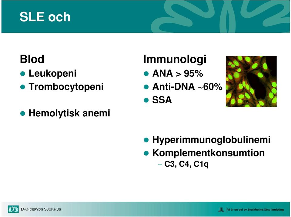 Anti-DNA ~60% SSA