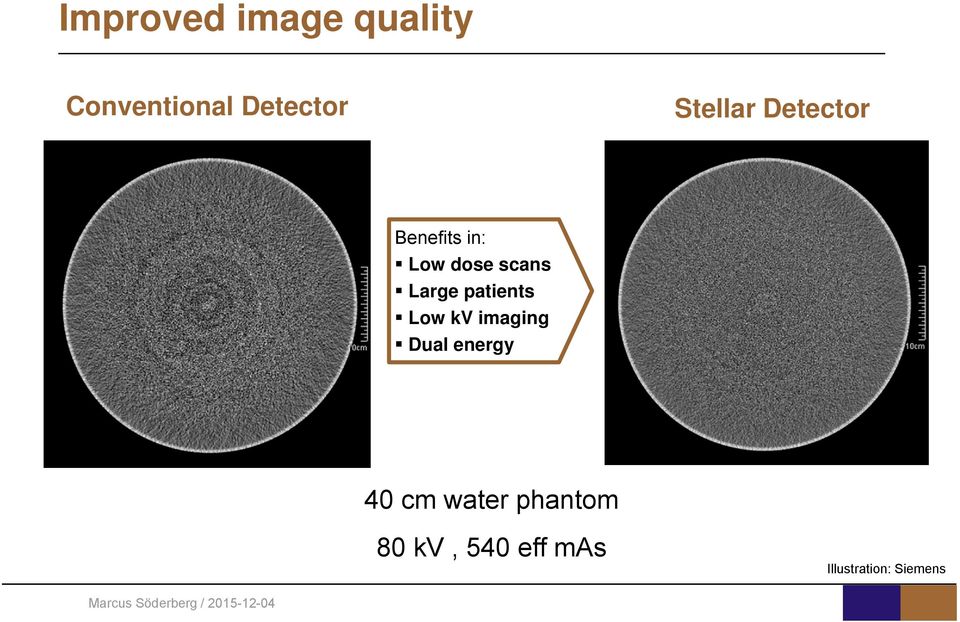 Large patients Low kv imaging Dual energy 40 cm