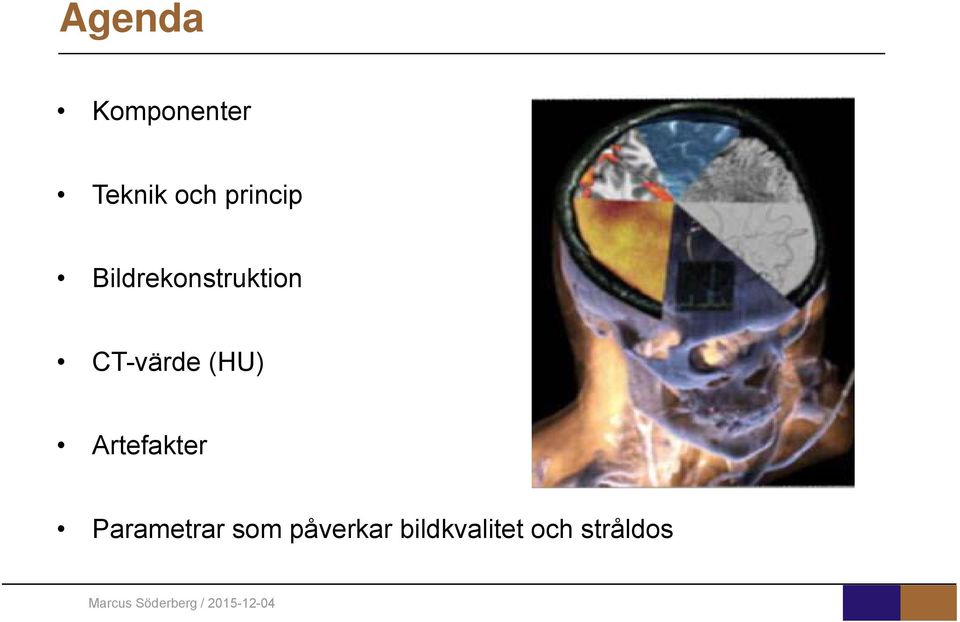 CT-värde (HU) Artefakter