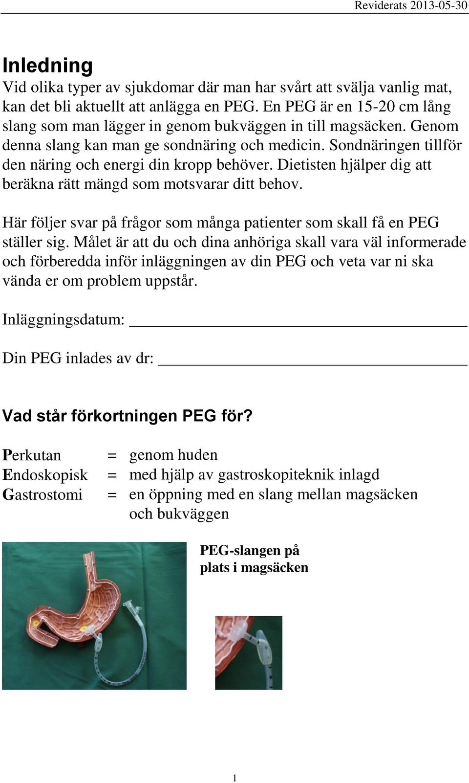 Dietisten hjälper dig att beräkna rätt mängd som motsvarar ditt behov. Här följer svar på frågor som många patienter som skall få en PEG ställer sig.