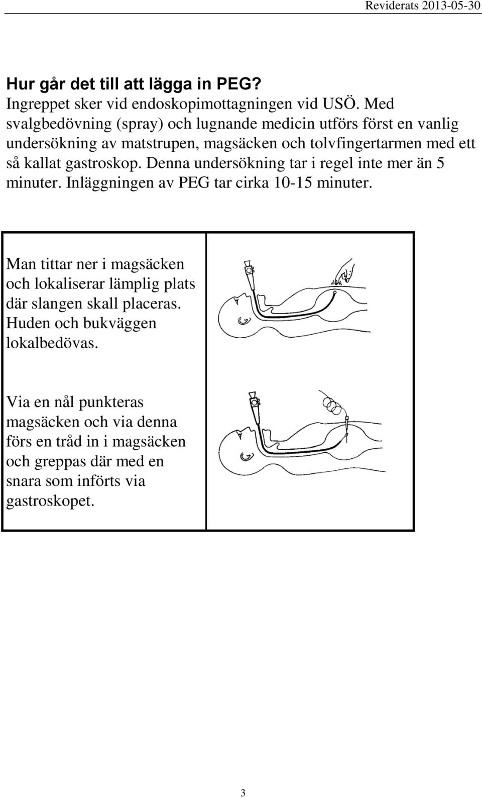 gastroskop. Denna undersökning tar i regel inte mer än 5 minuter. Inläggningen av PEG tar cirka 10-15 minuter.
