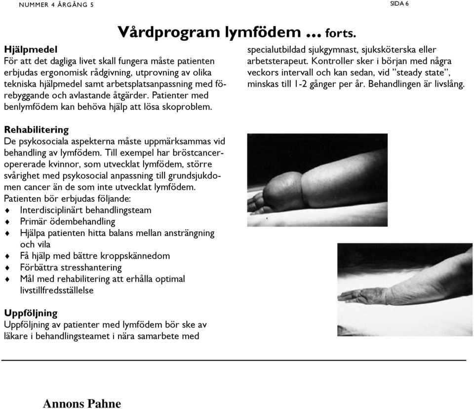 Till exempel har bröstcanceropererade kvinnor, som utvecklat lymfödem, större svårighet med psykosocial anpassning till grundsjukdomen cancer än de som inte utvecklat lymfödem.