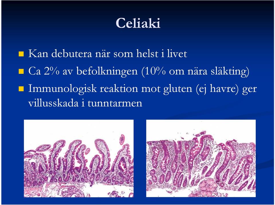 nära släkting) Immunologisk reaktion