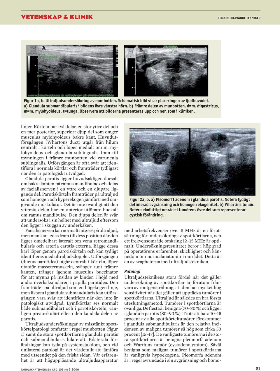 Körteln har två delar, en stor yttre del och en mer posterior, superiort djup del som omger musculus mylohyoideus bakre kant.