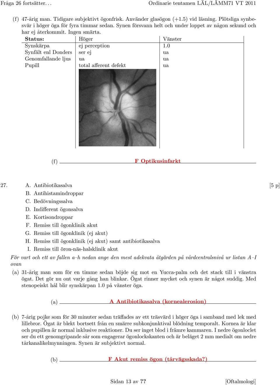 0 Synfält enl Donders ser ej ua Genomfallande ljus ua ua Pupill total afferent defekt ua (f) F Optikusinfarkt 27. A. Antibiotikasalva [5 p] B. Antihistamindroppar C. Bedövningssalva D.