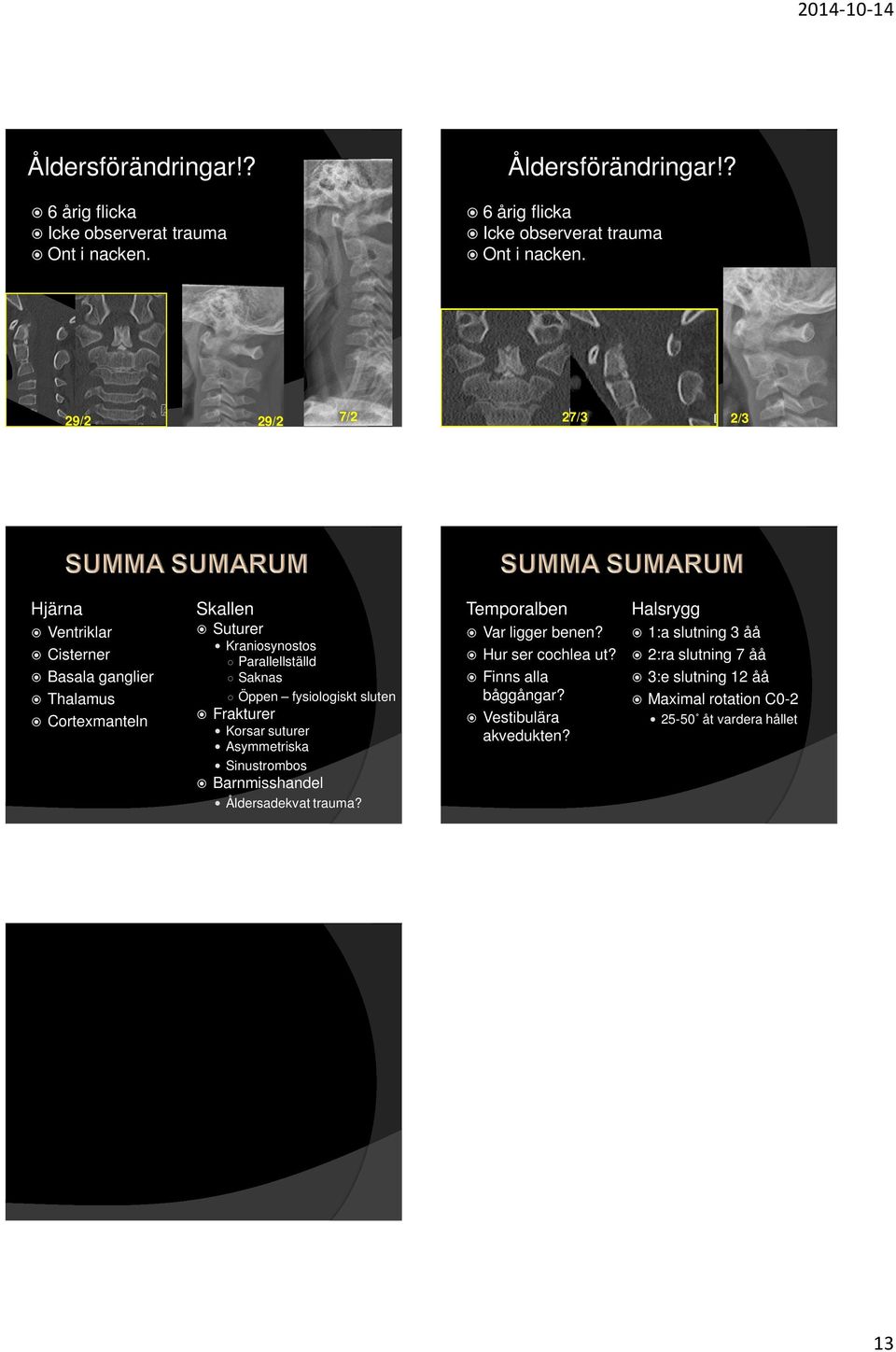 fysiologiskt sluten Frakturer Korsar suturer Asymmetriska Sinustrombos Barnmisshandel Åldersadekvat trauma? Temporalben Var ligger benen?