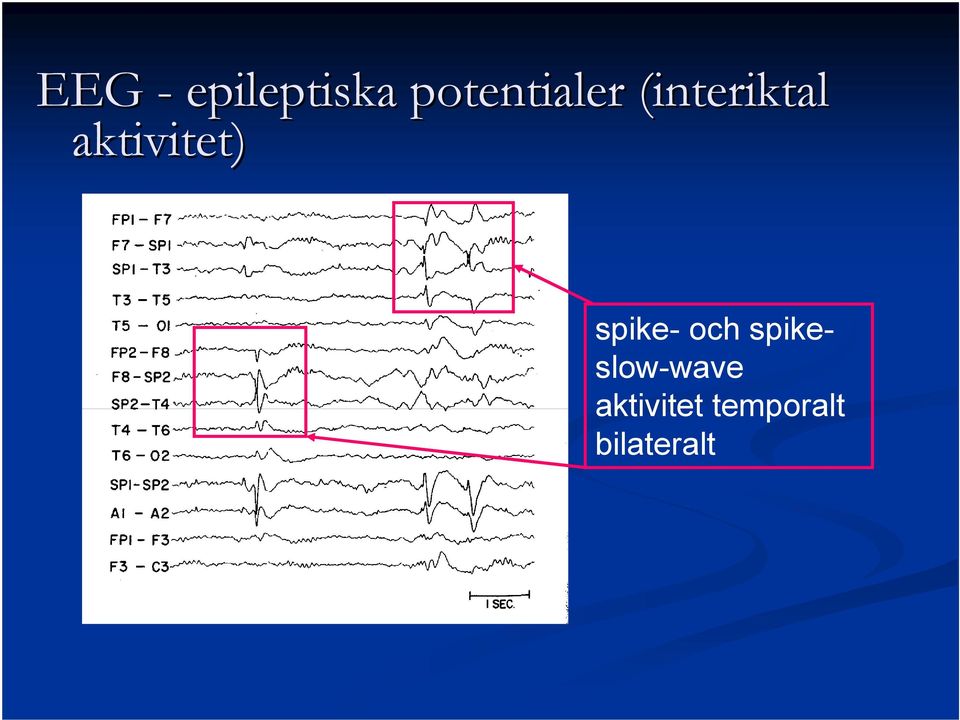 aktivitet) spike- och